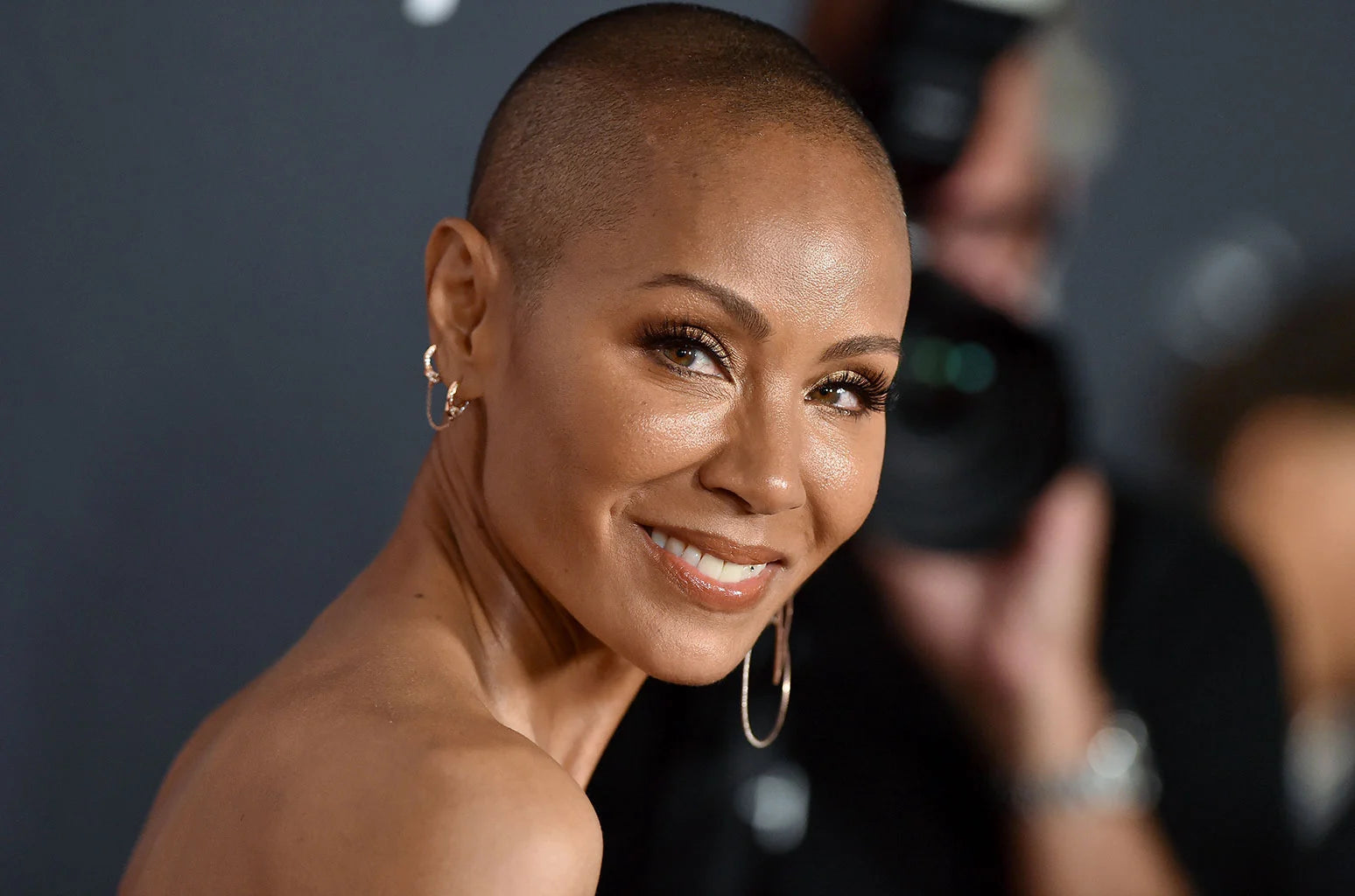 LIVING WITH ALOPECIA - CONFIDENCE BOOSTERS