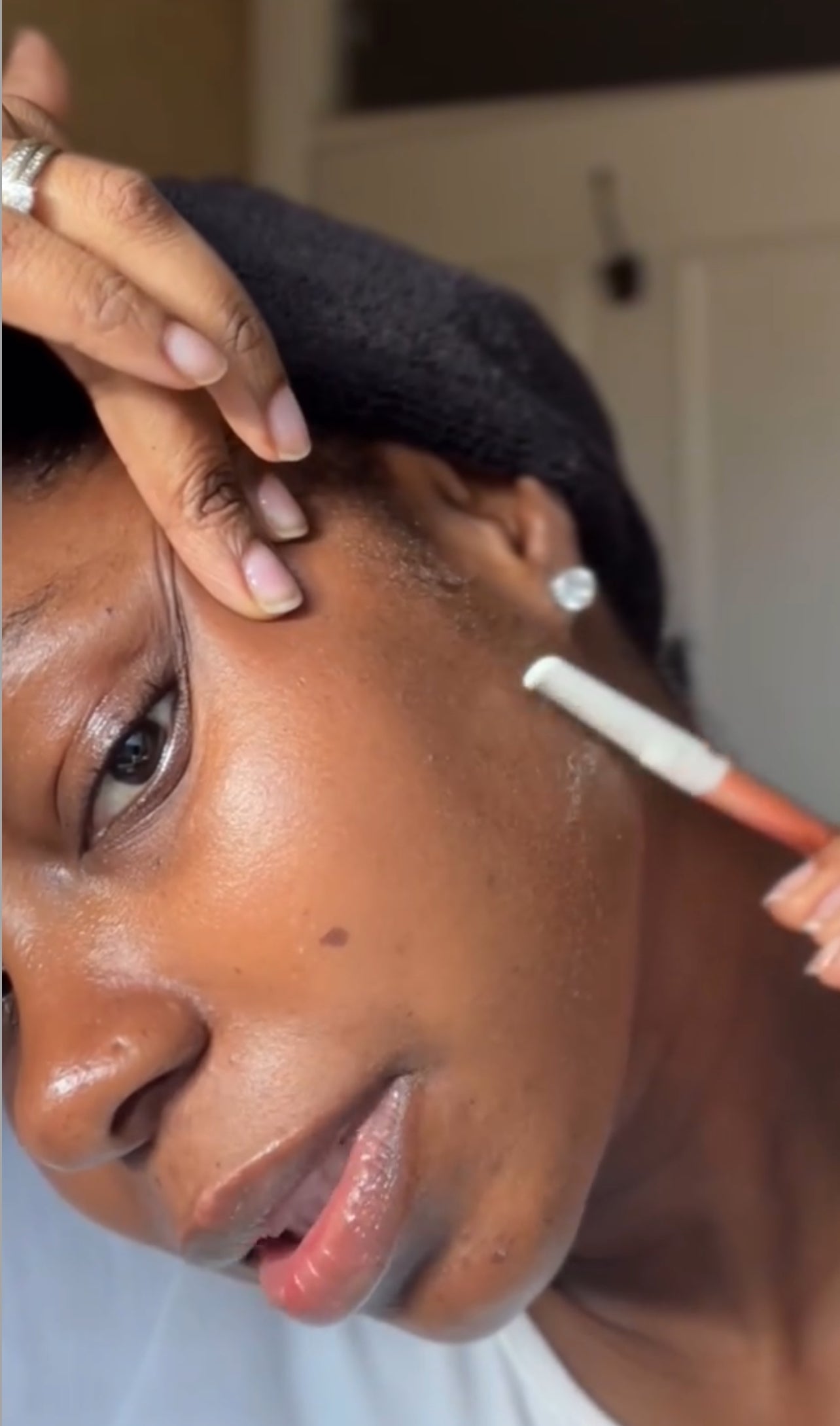Can Dermaplaning at Home Help with Acne?